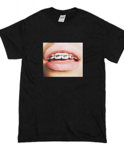 Braces Teeth T-Shirt (Oztmu)
